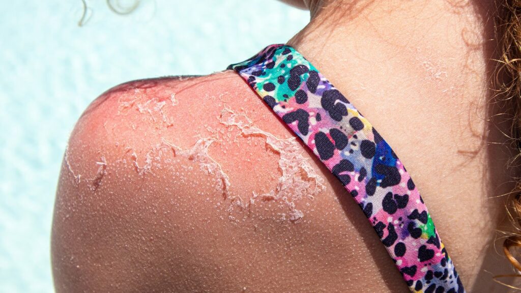 Link Between Hard Water and Skin Issues